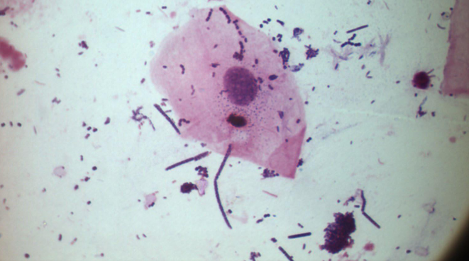 Microscopy sample with Gram staining