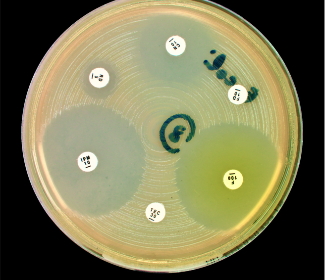 Antibiogram of E. coli using Kirby-Bauer method